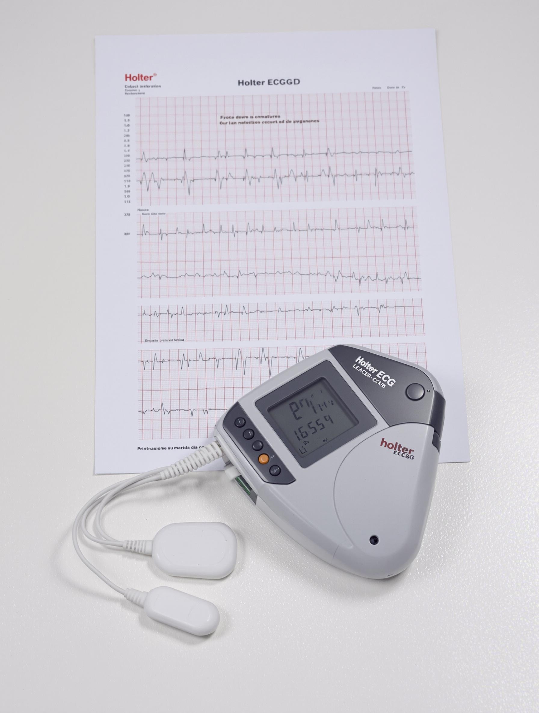 Boîtier Holter ECG posé sur une table avec électrodes et rapport imprimé en arrière-plan