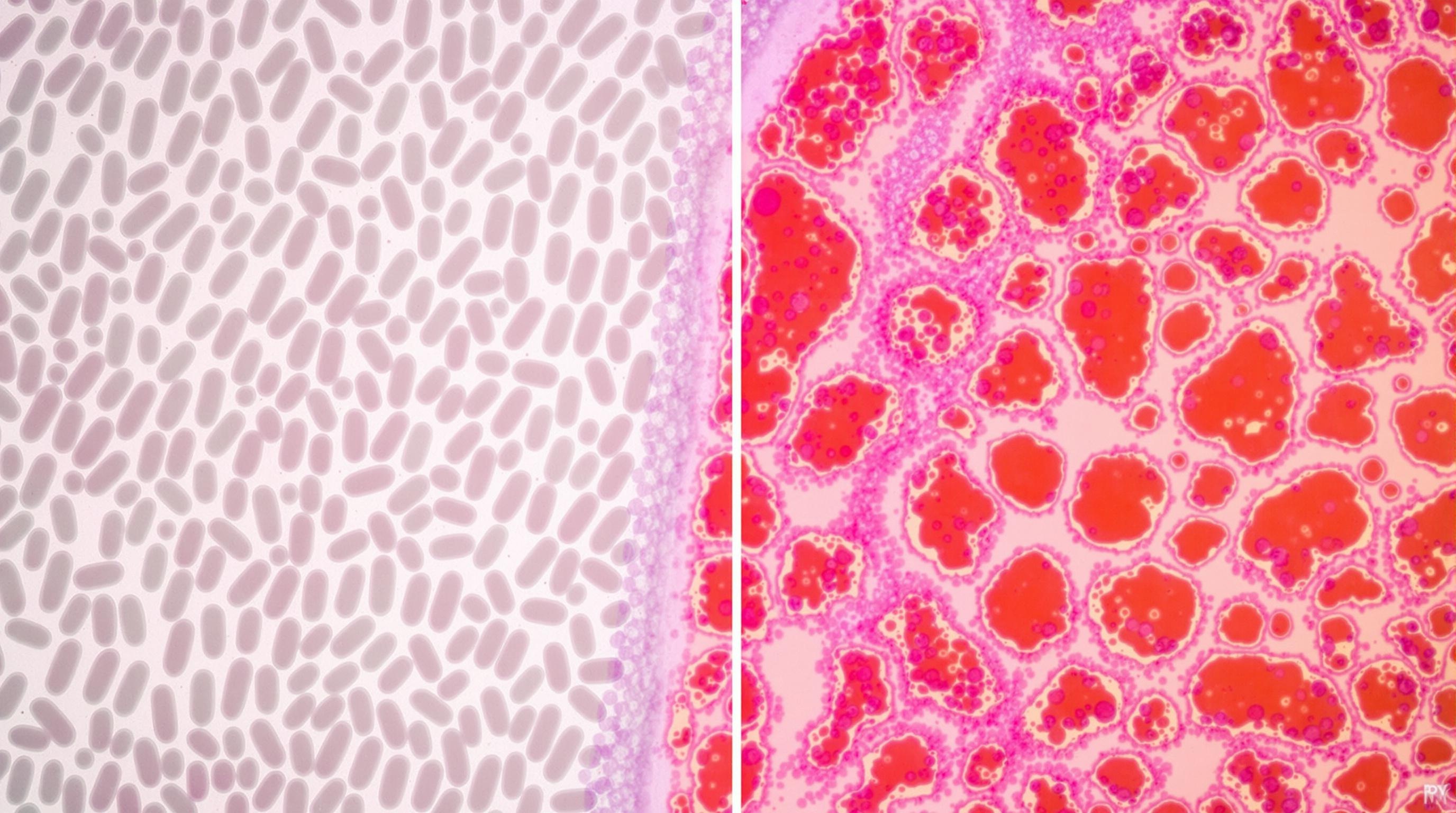 Microscopie optique : lactobacilles (bleu-vert) prospérant dans la flore vaginale saine ; contraste avec zone rouge-orangée affectée par les bactéries pathogènes.