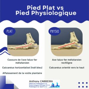 Comparaison de l'atrophie musculaire des pieds avec et sans semelles orthopédiques