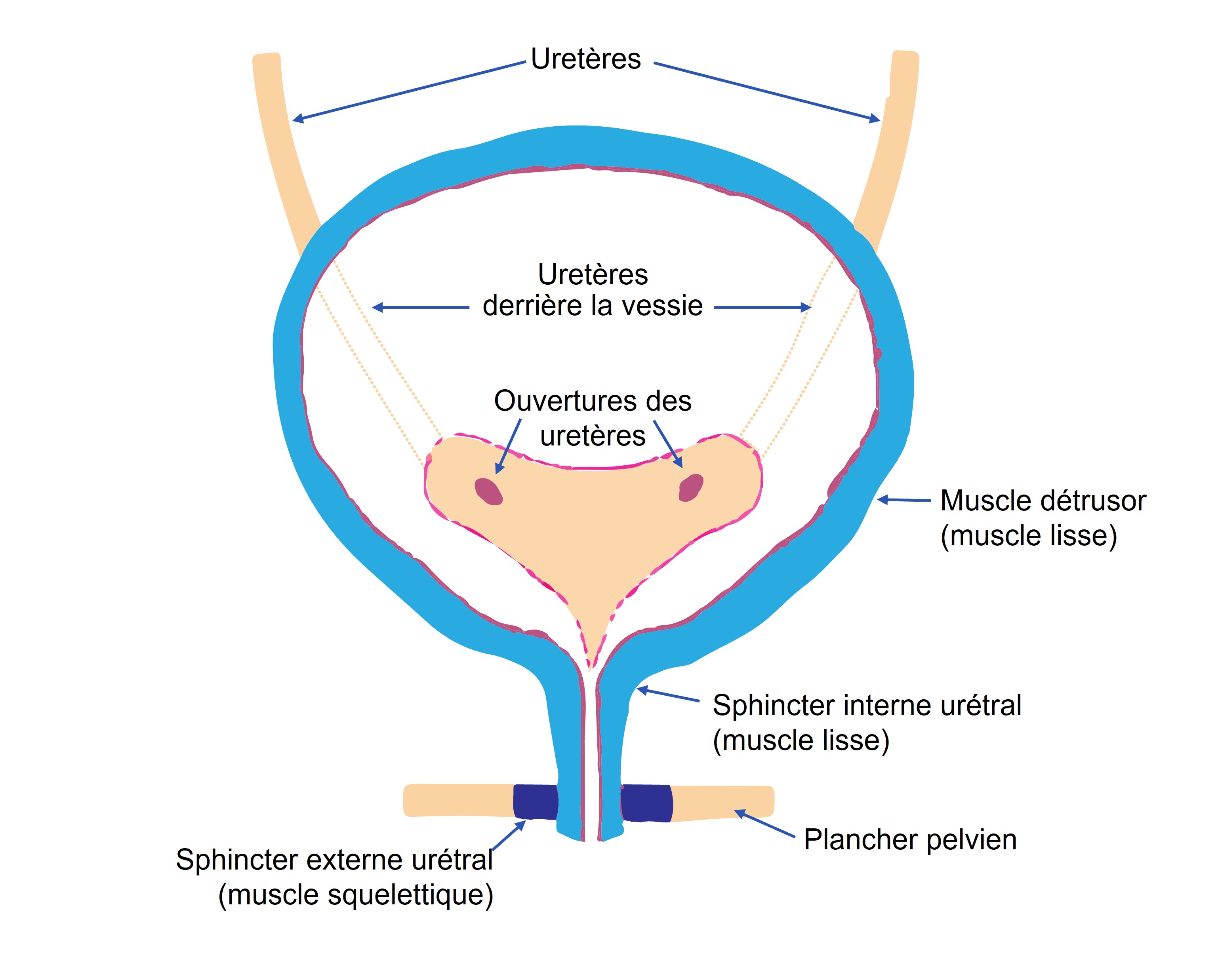Contrôle post-opératoire du résidu après une intervention sur la prostate