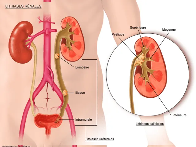 Schéma du système urinaire mettant en évidence les reins et l'uretère