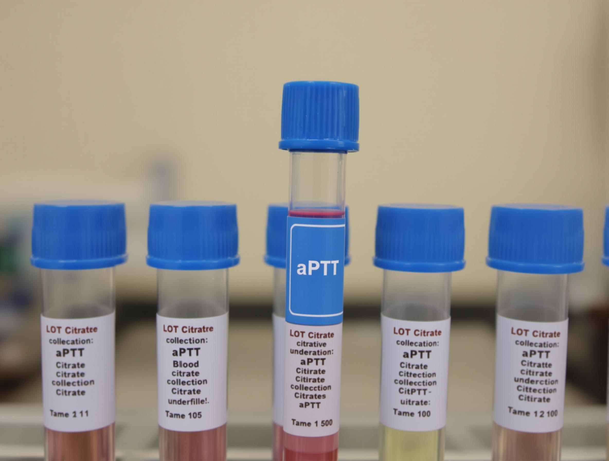 Tubes bleus au citrate utilisés pour le bilan de coagulation